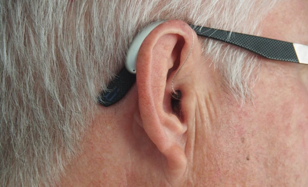 Photo Ear diagram